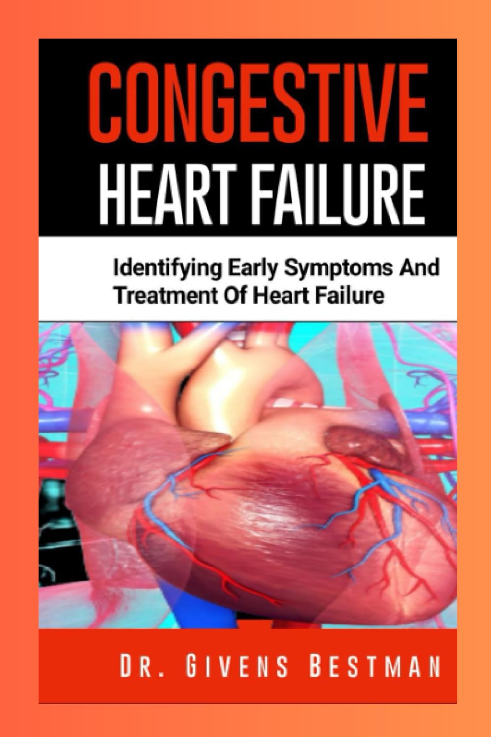 CONGESTIVE HEART FAILURE: Identifying Early Symptoms and Treatment of Heart Failure     Paperback – June 27, 2023